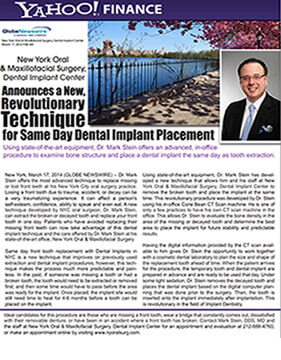 Yahoo! Finance Features Dental Implant Specialist Mark Stein