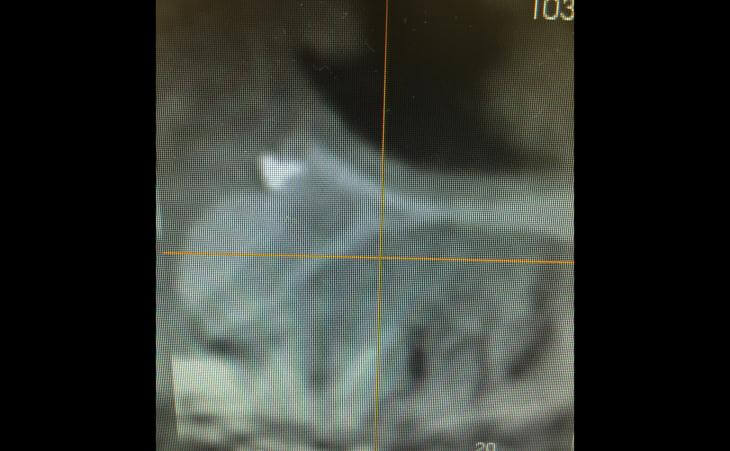 CT Scan Of Reconstructed Dental Bone